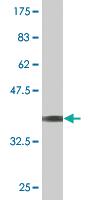 Anti-PI4KB Mouse Monoclonal Antibody [clone: 3B1]