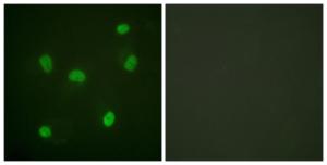 Immunofluorescence analysis of HeLa cells using Anti-Histone H2B Antibody The right hand panel represents a negative control, where the antibody was pre-incubated with the immunising peptide