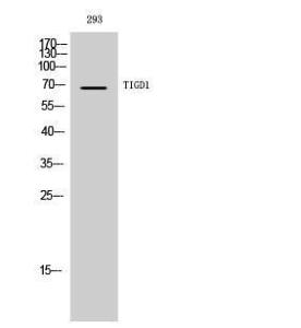 Western blot analysis of 293 cells using Anti-TIGD1 Antibody