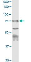 Anti-CAPN1 Rabbit Polyclonal Antibody