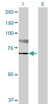 Anti-ST6GALNAC1 Mouse Polyclonal Antibody