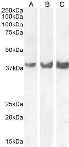 Anti-HOXD13 Antibody (A85094) (03 µg/ml) staining of Human (A), Mouse (B) and (01 µg/ml) Rat (C) Brain lysate (35 µg protein in RIPA buffer) Detected by cemiluminescence