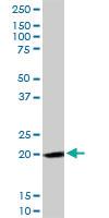 Anti-FTH1 Rabbit Polyclonal Antibody