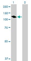 Anti-PTPN12 Mouse Polyclonal Antibody