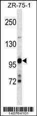 Anti-ULK2 Rabbit Polyclonal Antibody (FITC (Fluorescein Isothiocyanate))