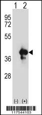 Anti-APEX1 Rabbit Polyclonal Antibody