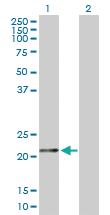 Anti-FTH1 Rabbit Polyclonal Antibody