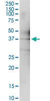 Anti-OBFC1 Polyclonal Antibody Pair