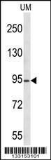 Anti-KAT2A Rabbit Polyclonal Antibody (APC (Allophycocyanin))