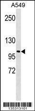 Anti-LOXL2 Rabbit Polyclonal Antibody (AP (Alkaline Phosphatase))