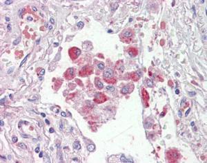 Anti-OSBPL9 Antibody (A83439) (2.5 µg/ml) staining of paraffin embedded Human Lung. Steamed antigen retrieval with citrate buffer pH 6, AP-staining