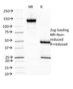 SDS-PAGE analysis of Anti-HSP27 Antibody [SPM252] under non-reduced and reduced conditions; showing intact IgG and intact heavy and light chains, respectively. SDS-PAGE analysis confirms the integrity and purity of the antibody