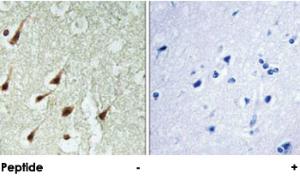 Anti-PRKCQ Rabbit Polyclonal Antibody