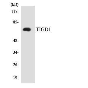 Western blot analysis of the lysates from HeLa cells using Anti-TIGD1 Antibody