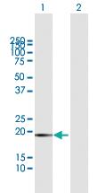 Anti-FTL Mouse Polyclonal Antibody