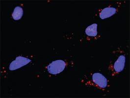 Anti-BDNF + NTF4 Antibody Pair