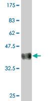 Anti-AMPD2 Mouse Monoclonal Antibody [clone: 2F5]