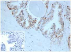 Immunohistochemical analysis of formalin-fixed, paraffin-embedded human prostate tissue using Anti-HLA G Antibody [HLAG/6686] at 2 µg/ml. Inset: PBS instead of the primary antibody. Secondary antibody negative control