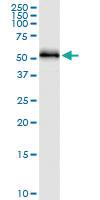 Anti-HARS Polyclonal Antibody Pair