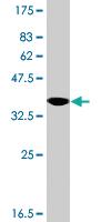 Anti-GTPBP3 Mouse Polyclonal Antibody