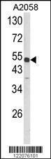 Anti-ANXA7 Rabbit Polyclonal Antibody (Biotin)