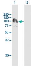 Anti-PKN3 Rabbit Polyclonal Antibody