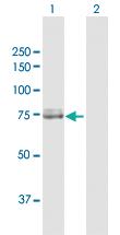 Anti-CAPN2 Rabbit Polyclonal Antibody