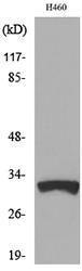 Antibody anti-TFPI2 100 µg