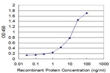 Anti-FTL Mouse Monoclonal Antibody [clone: 4D11]