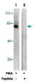 Anti-PRKCZ Rabbit Polyclonal Antibody