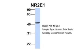 Anti-NR2E1 Rabbit Polyclonal Antibody