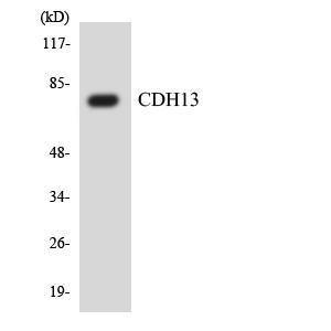 Western blot analysis of the lysates from HT 29 cells using Anti-CDH13 Antibody