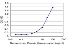 Anti-FTL Mouse Monoclonal Antibody [clone: 1C2]