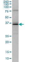 Anti-UBE2J1 Mouse Monoclonal Antibody [clone: 6A12]