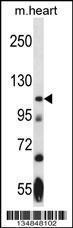 Anti-NEK9 Rabbit Polyclonal Antibody (AP (Alkaline Phosphatase))