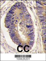 Anti-PTPN3 Rabbit Polyclonal Antibody (HRP (Horseradish Peroxidase))