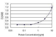 Anti-RNF168 Polyclonal Antibody Pair