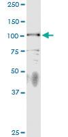 Anti-PKN3 Rabbit Polyclonal Antibody