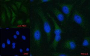 Anti-PTCH1 Antibody (A83443) Immunofluorescence analysis of paraformaldehyde fixed HeLa cells, permeabilized with 0.15% Triton. Primary incubation 1hr (5 µg/ml) followed by Alexa Fluor 488 secondary antibody (1 µg/ml), showing cytoplasmic staining. The nuclear stain is DAPI (blue)