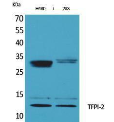 Antibody anti-TFPI2 100 µg