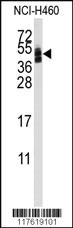 Anti-CXADR Rabbit Polyclonal Antibody