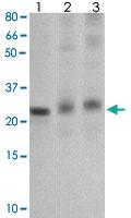 Anti-SOCS1 Rabbit Polyclonal Antibody