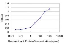 Anti-UBE2J1 Mouse Monoclonal Antibody [clone: 6A12]