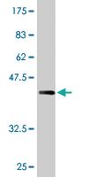 Anti-AMPD2 Mouse Monoclonal Antibody [clone: 2F5]