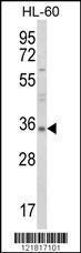 Anti-TNFSF11 Rabbit Polyclonal Antibody (HRP (Horseradish Peroxidase))