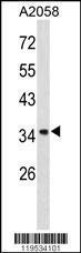 Anti-ANXA1 Rabbit Polyclonal Antibody