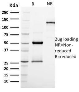 SDS-PAGE analysis of Anti-Podocalyxin Antibody [PODXL/2185] under non-reduced and reduced conditions; showing intact IgG and intact heavy and light chains, respectively. SDS-PAGE analysis confirms the integrity and purity of the Antibody