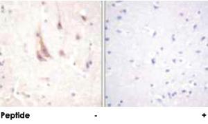 Anti-PRKCZ Rabbit Polyclonal Antibody