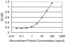 Anti-GPAT4 Mouse Monoclonal Antibody [clone: 4C12]