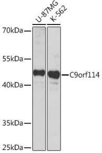 Western blot analysis of extracts of various cell lines, using Anti-SPOUT1 Antibody (A306220) at 1:1000 dilution